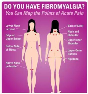 Do I have fibromyalgia?